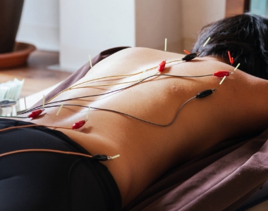 Boulder Japanese Acupuncture micro current e stim